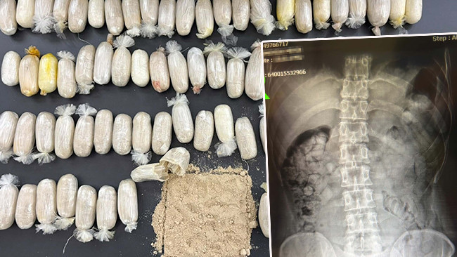 Latest Development: They were stopped on suspicion: Drugs were found in the stomachs of 2 Iranians