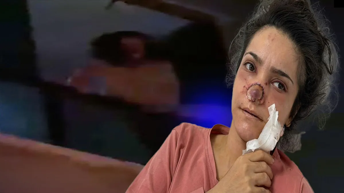 Sıcak Gündem: Manisa'da cani koca dehşeti! Tartıştığı eşinin burnunu koparmıştı: "Canımın acısıyla balkondan a