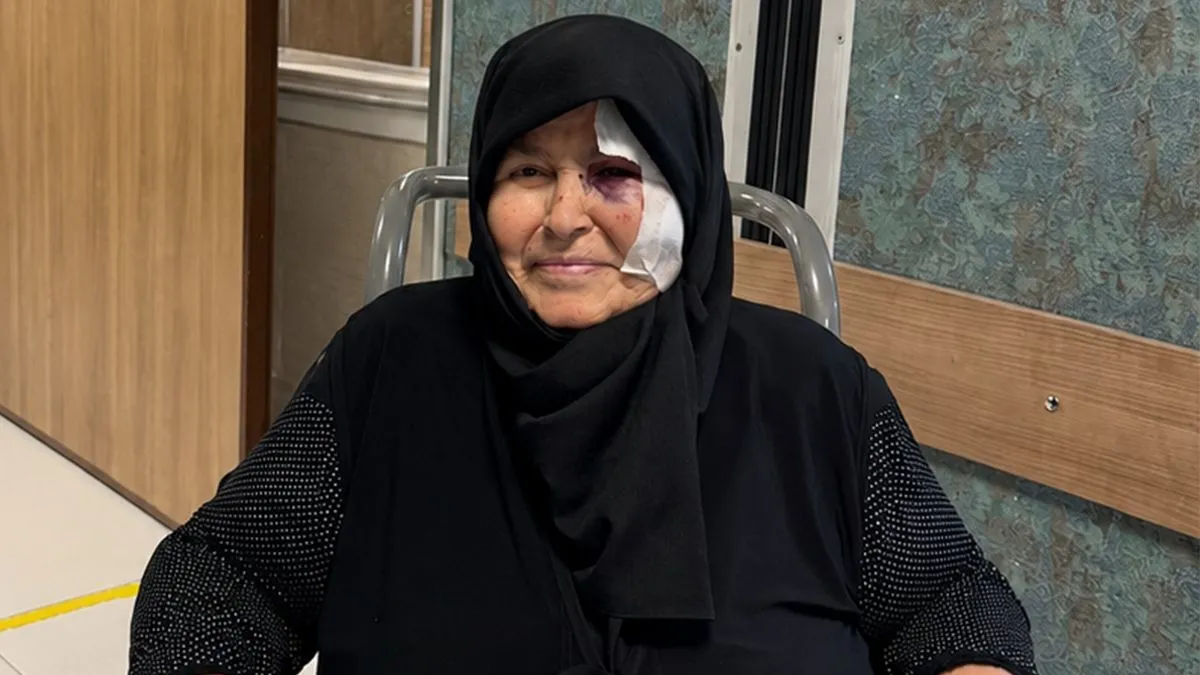 Ayrıntılar Netleşti: Yaban arısının soktuğu kadın Yaşamını Yitirdi: İşte Ayrıntılar - Son Dakika Bilgileri