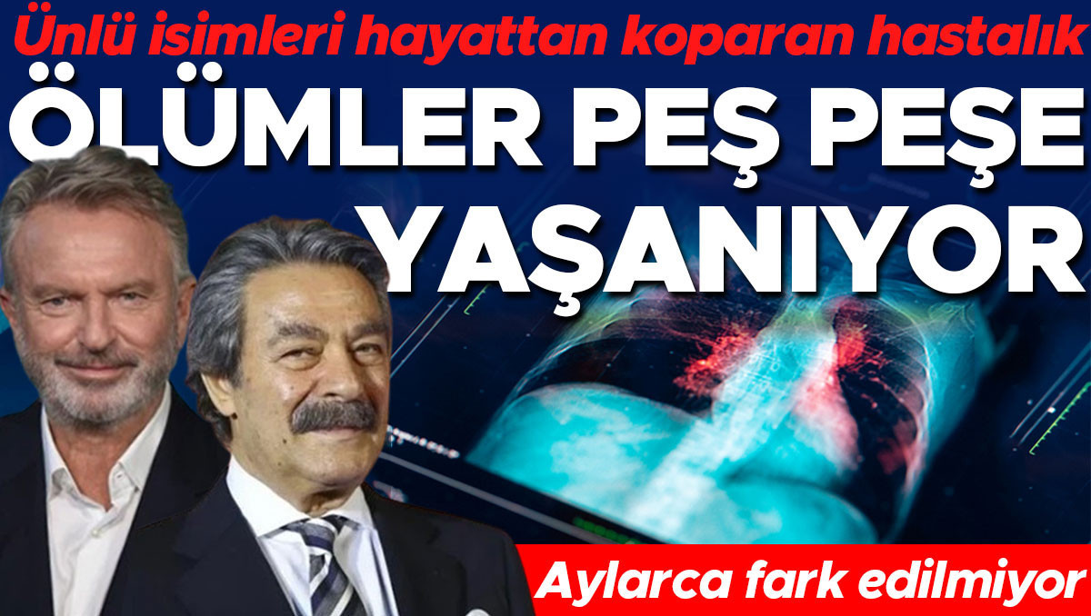 Ölümler peş peşe yaşanıyor... Ünlü isimleri hayattan koparan hastalık! Aylarca fark edilmiyor, üstelik her yaş