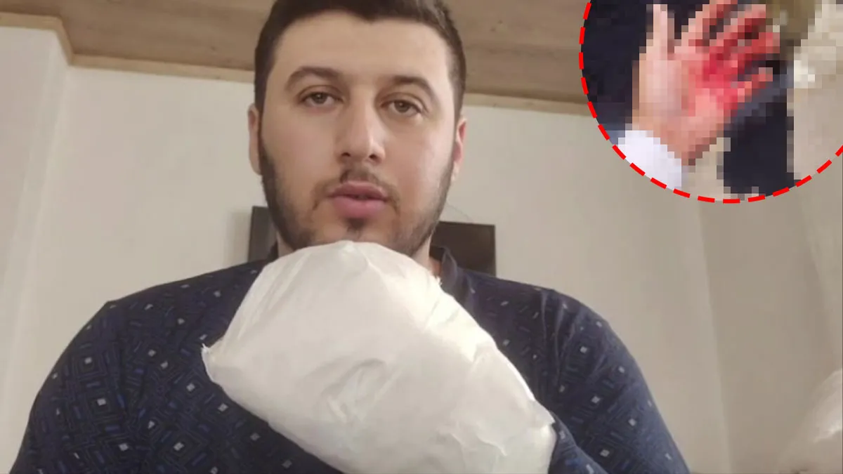 Kritik Açıklama: Analiz | Antalya’da döner bıçaklı saldırı! Sipariş almaya gitti dehşeti yaşadı: 'Avuç içimi i