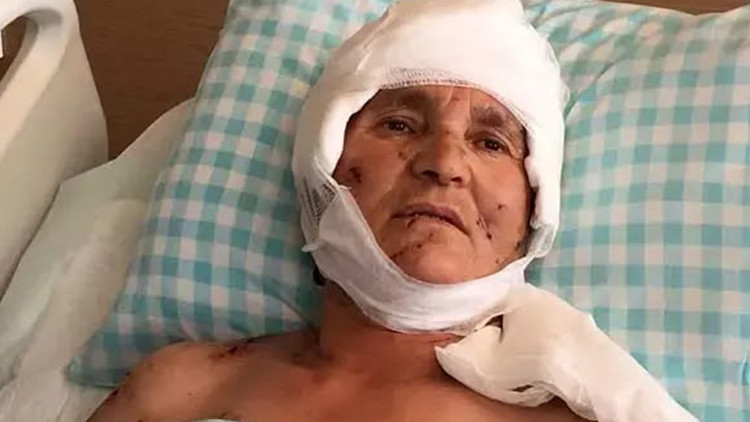 Kritik Açıklama: Yargıtay'dan köpek saldırısı kararı: Malul kalan kadına 637 bin lira tazminat