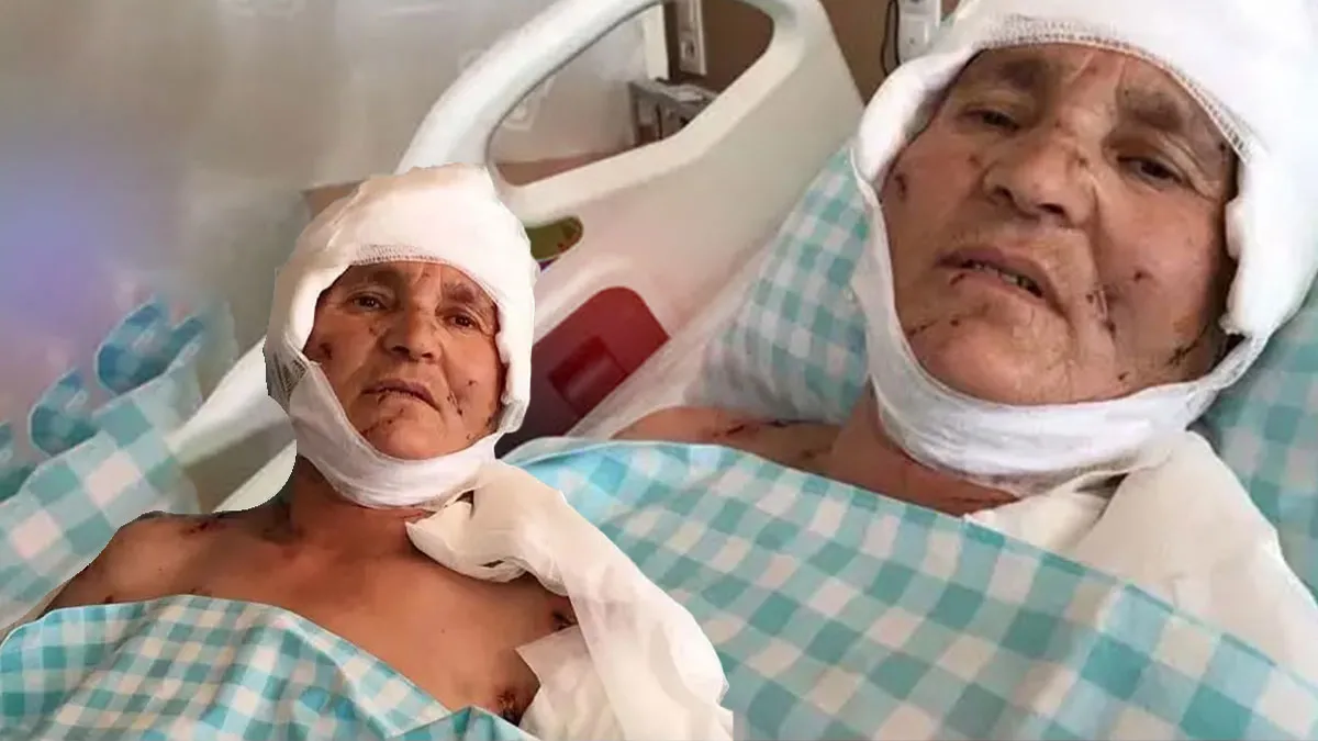 Sıcak Gündem: Son Gelişme: Yargıtay’dan emsal karar! Sürü halindeki köpekler yaşlı kadına saldırdı: Dudak uçuk