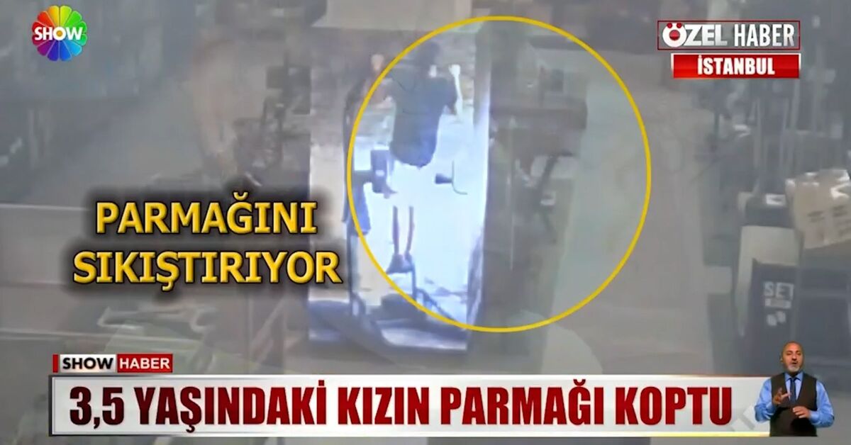Küçük kızın büyük acısı!: Gelişmeler Takip Ediliyor