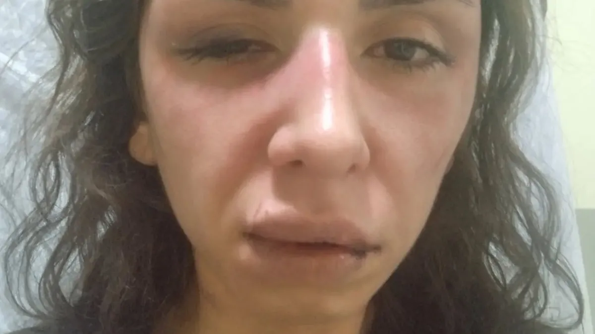 Son Gelişme: Çekmeköy'de korkunç olay: Cani kocasından 4 saat işkence gördü! O video sonrası harekete geçildi.
