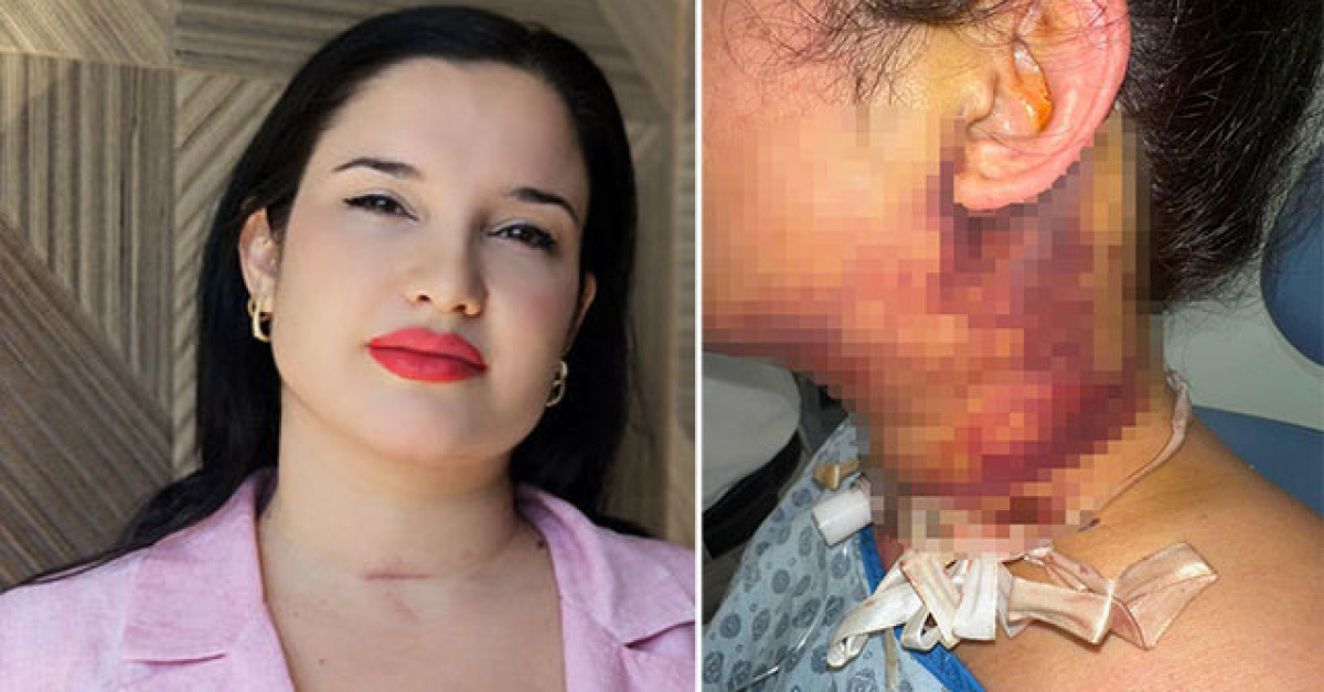 Son Gelişme: Estetik operasyonu kâbusla son buldu! ve Merak Edilenler