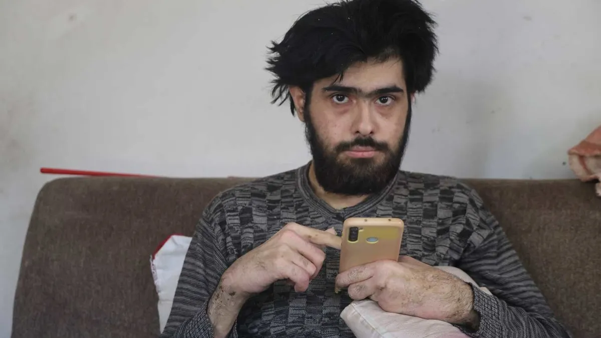 Gündemden Son Bilgiler: SON DAKİKA… Tüm Türkiye onu konuşmuştu! Telefon bağımlısı Barış Özbay’dan üzen haber g