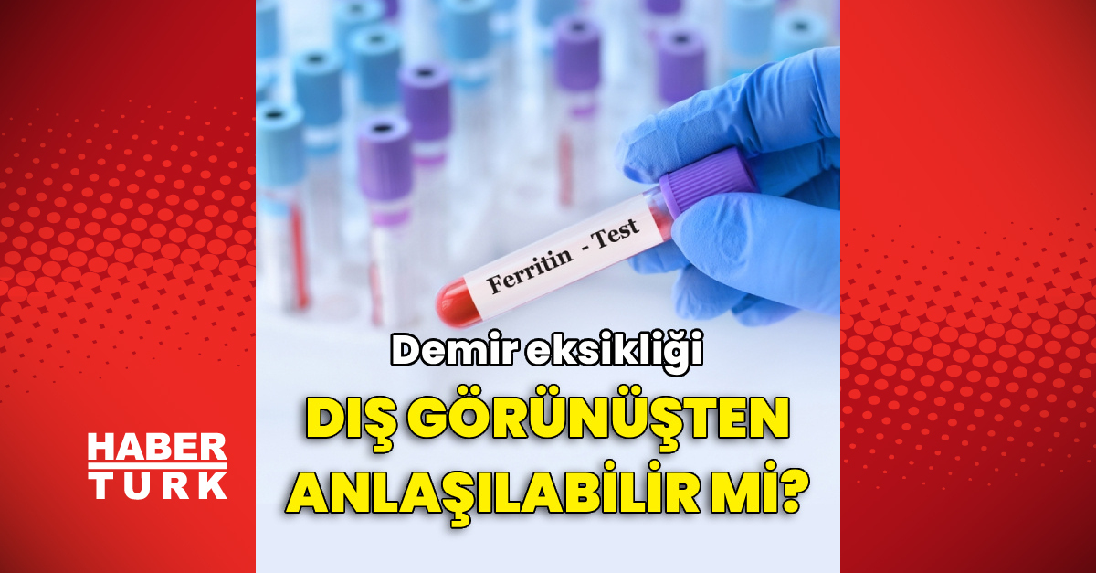 Son Gelişme: Demir eksikliği dış görünüşten anlaşılabilir mi?