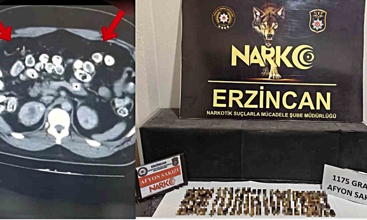 Ayrıntılar Netleşti: Erzincan’da uyuşturucuyu vücutlarında taşıyan 3 şüpheli yakalandı ve Merak Edilenler