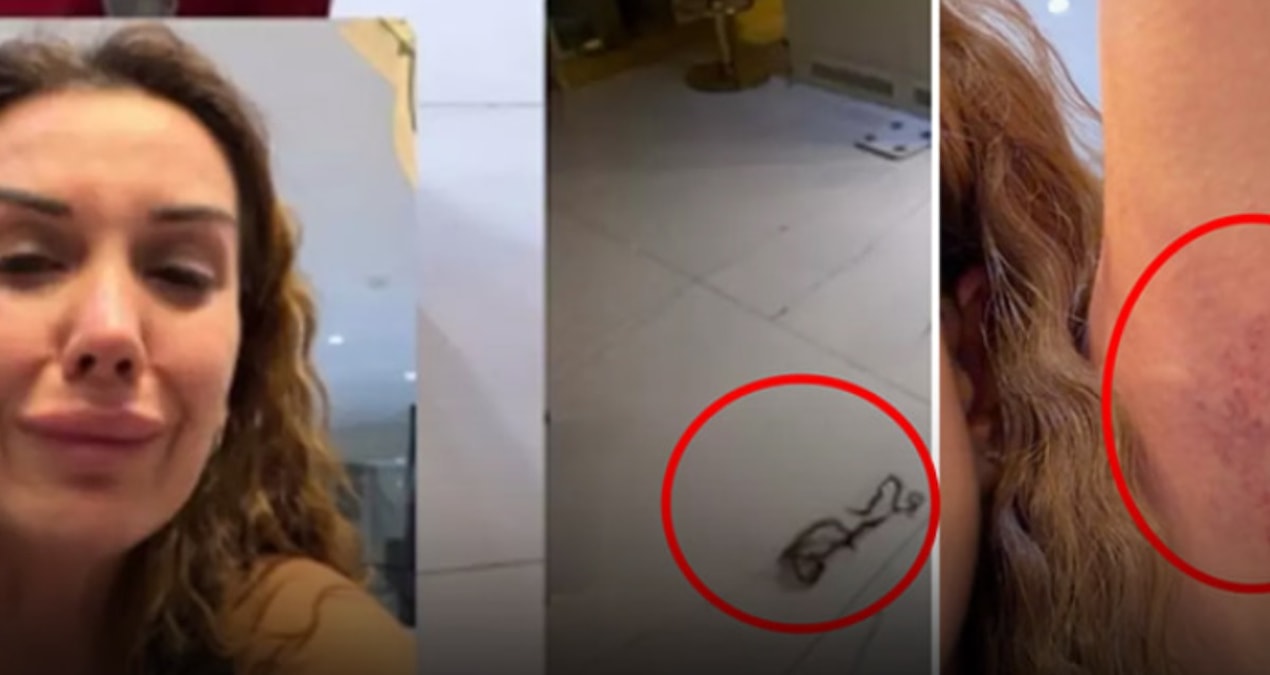 Ayrıntılar Netleşti: Dilan Polat en yakınından tekme tokat dayak yedi - Son Dakika | İşte Tüm Ayrıntılar
