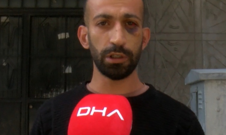 Gaziosmanpaşa’da taciz iddiasıyla darbedilen kiracı: Fatura ödemeleri yüzünden tartıştık ve Merak Edilenler