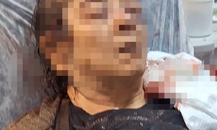 Gündemden Son Bilgiler: Kayseri Melikgazi'de tavandan kopan moloz altında kalan 75 yaşındaki F.Ö. yaralandı ve
