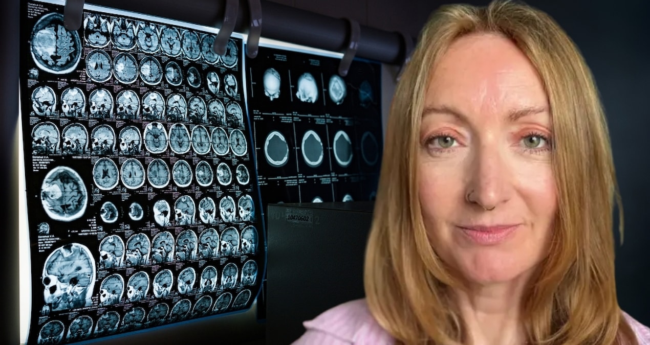 38 parasites were detected in his brain after his India holiday - Last Minute