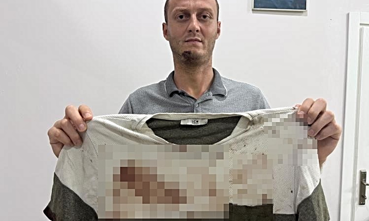 Kritik Açıklama: Antalya Serik'te gürültü tartışmasında bir kişi 5 kişiden darp iddiasıyla şikayetçi oldu ve M