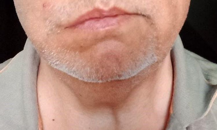 Pamukkale Tourism assistant punched the doctor who asked for water - News