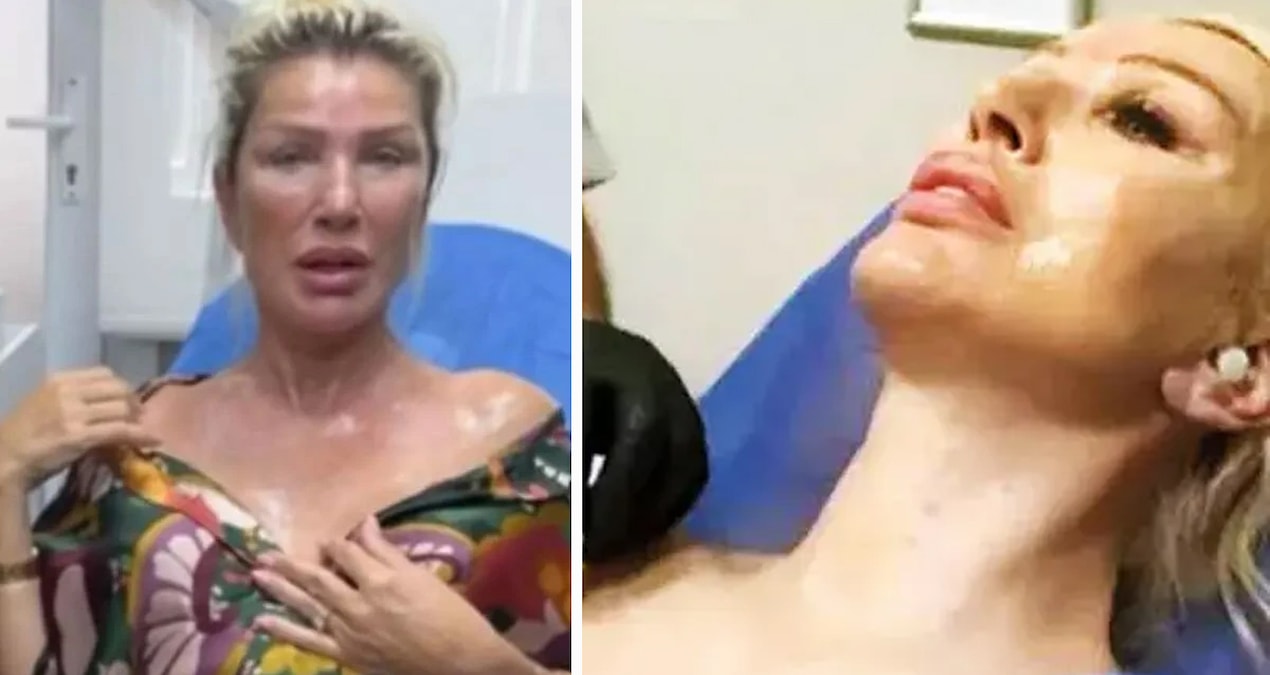 Seda Sayan itiraf etti: Meğer cilt altını ışınla yaktırmış! - Son Dakika Haberleri ve Merak Edilenler