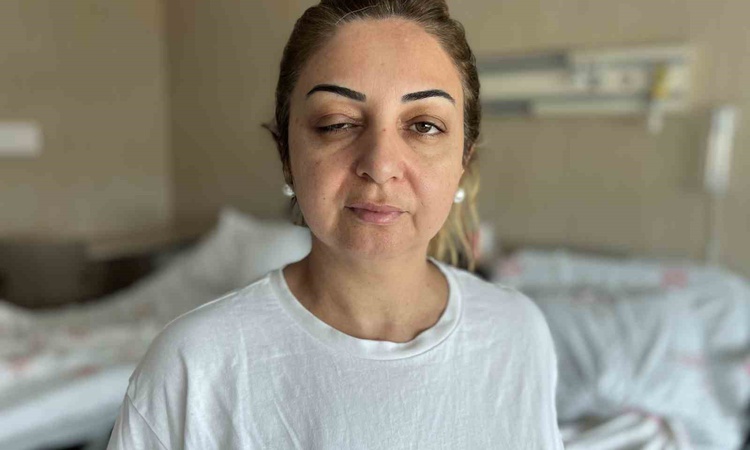 Son Gelişme: Mersin Tarsus'ta botoks yaptıran 3 kadın Mersin Şehir Hastanesi'nde tedavi altına alındı - Son Da