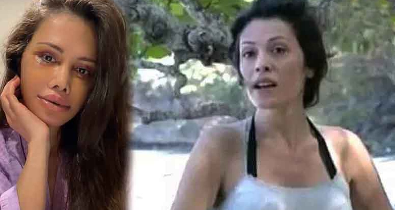 Gündemden Son Bilgiler: Survivor'ın eski yarışmacısı Didem Ceran 'yüz nakli' operasyonu geçirdi - En Son Haber