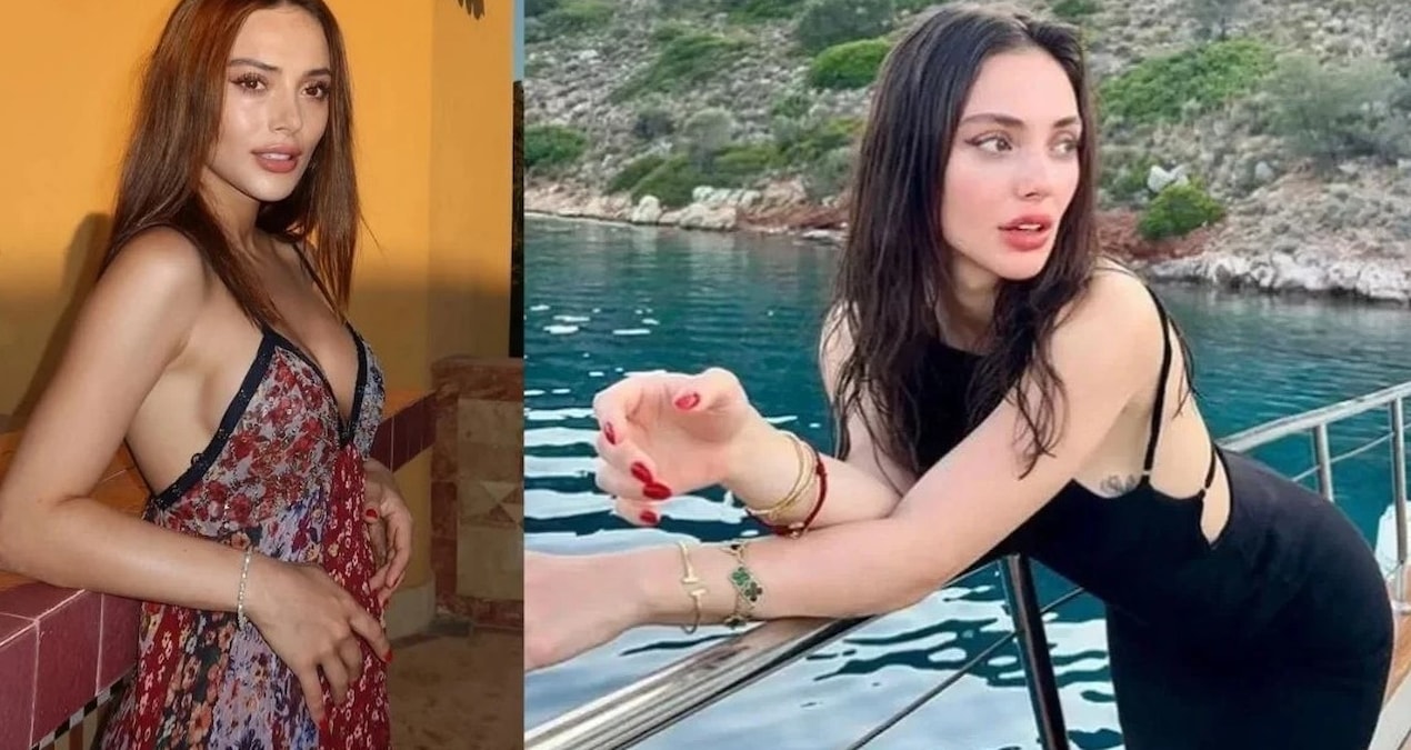 Son Gelişme: TRT dizisinde set kazası! Ünlü oyuncunun parmağı kopma noktasına geldi - Son Dakika Haberleri ve